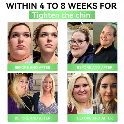 🇺🇸Alcuras™ Moringa × Berberine × AMPK 8-Benefit Slimming & Met0abolic Nano Microneedle Patch🌿